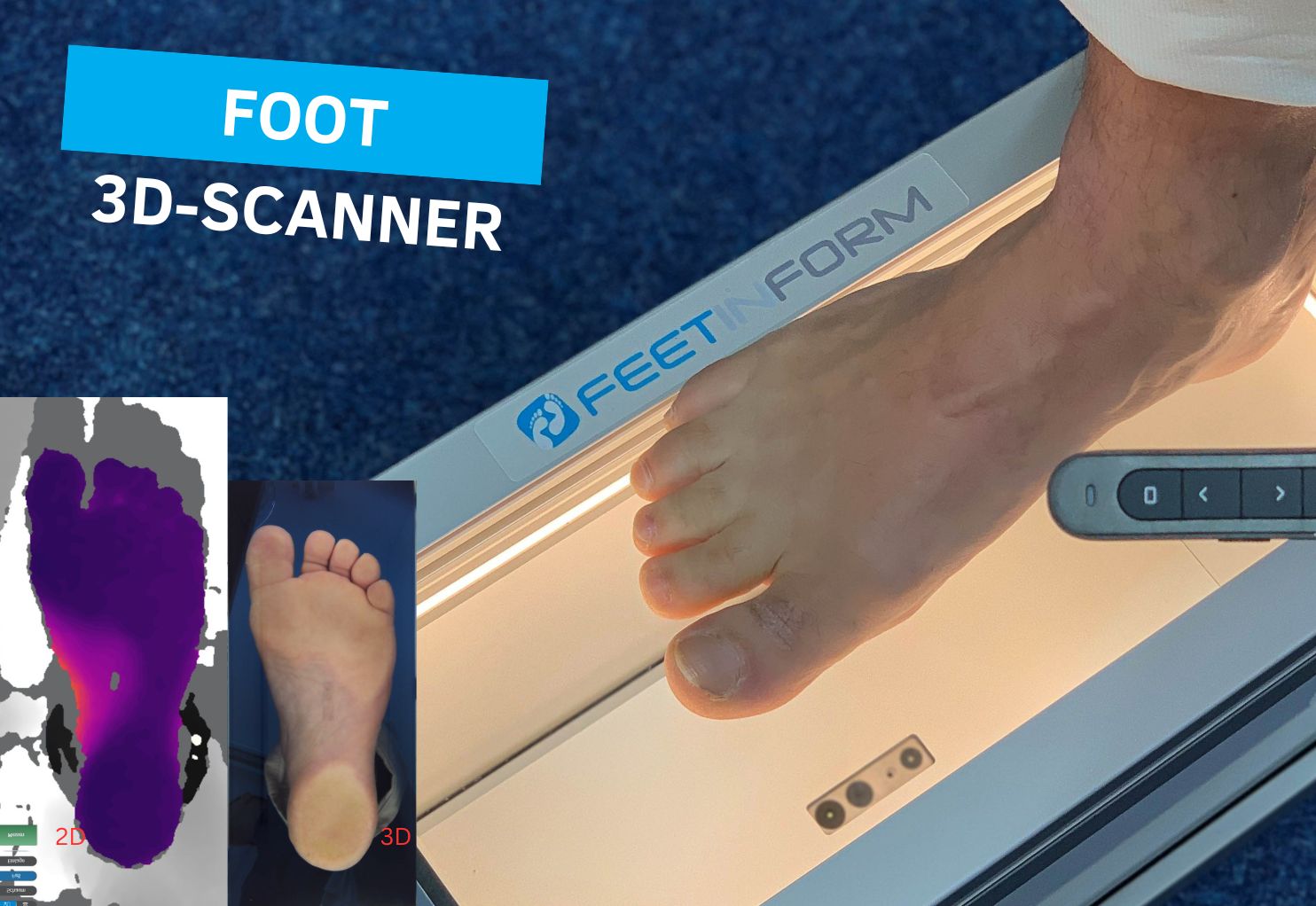 KOBRA II foot measurement Measurement process of a foot with the optical 3D scanner Kobra II, showing how the scan appears on the camera display